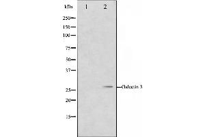 Western blot analysis on HeLa cell lysate using Galectin 3 Antibody,The lane on the left is treated with the antigen-specific peptide. (Galectin 3 anticorps  (Internal Region))