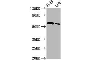 Western Blot Positive WB detected in: A549 whole cell lysate, LO2 whole cell lysate All lanes: PARP3 antibody at 3. (PARP3 anticorps  (AA 1-240))