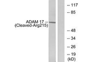 Western blot analysis of extracts from rat liver cells, using ADAM 17 (Cleaved-Arg215) Antibody. (ADAM17 anticorps  (Cleaved-Arg215))