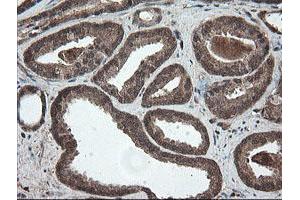 Image no. 12 for anti-Pyridoxamine 5'-Phosphate Oxidase (PNPO) antibody (ABIN1500318)