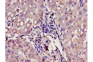Immunohistochemistry of paraffin-embedded human liver tissue using ABIN7154509 at dilution of 1:100 (Growth Hormone Receptor anticorps  (AA 19-184))
