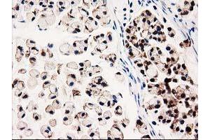 Image no. 5 for anti-UDP-Galactose-4-Epimerase (GALE) antibody (ABIN1498366) (GALE anticorps)