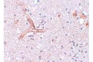 Immunohistochemical staining of human brain tissue with ZC3H12C polyclonal antibody  at 5 ug/mL dilution. (ZC3H12C anticorps  (N-Term))