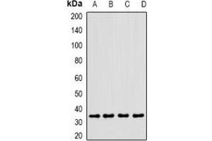 Western blot analysis of CLEC12A expression in MCF7 (A), U937 (B), mouse heart (C), rat liver (D) whole cell lysates.