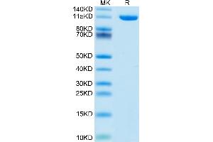 Mouse Neuropilin-2 on Tris-Bis PAGE under reduced condition.