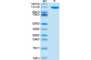 Mouse Neuropilin-2 on Tris-Bis PAGE under reduced condition. (NRP2 Protein (AA 23-859) (His tag))