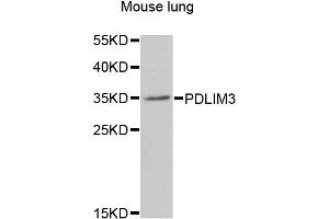 Western blot analysis of extracts of mouse lung, using PDLIM3 antibody (ABIN5975262) at 1/1000 dilution. (PDLIM3 anticorps)