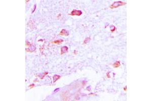 Immunohistochemical analysis of NSG2 staining in human brain formalin fixed paraffin embedded tissue section. (NSG2 anticorps  (Center))