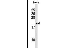 IP2 Antibody (N-term) (ABIN1539498 and ABIN2848464) western blot analysis in Hela cell line lysates (35 μg/lane). (PAIP2 anticorps  (N-Term))