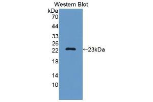 Figure. (SF3B3 anticorps  (AA 35-210))