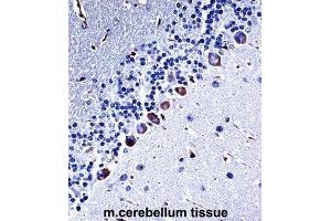 Immunohistochemistry (IHC) image for anti-Casein Kinase 1, gamma 3 (CSNK1G3) antibody (ABIN2997618)