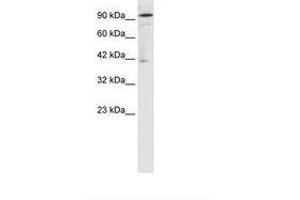Image no. 1 for anti-OTU Domain Containing 7B (OTUD7B) (AA 559-608) antibody (ABIN202938)