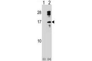 Western blot analysis of CLC (arrow) using rabbit polyclonal CLC Antibody (C-term) . (Galectin 10 anticorps  (C-Term))