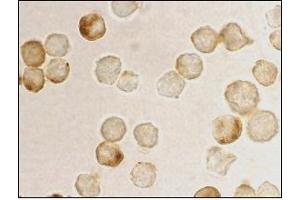 Immunocytochemistry staining of HeLa using AP30669PU-N at 10 μg/ml. (MTA2 anticorps  (AA 652-668))