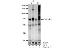 Western blot analysis of extracts of various cell lines, using Phospho-T-S412 antibody (ABIN3019511, ABIN3019512, ABIN3019513 and ABIN6225441) at 1:1000 dilution. (MAP3K7 anticorps  (pSer412))