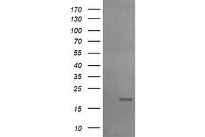 Image no. 1 for anti-Ubiquitin-Conjugating Enzyme E2G 2 (UBE2G2) antibody (ABIN1501635) (UBE2G2 anticorps)