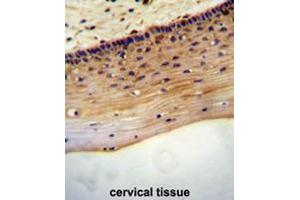 LRC18 antibody (C-term) immunohistochemistry analysis in formalin fixed and paraffin embedded human cervical tissue followed by peroxidase conjugation of the secondary antibody and DAB staining.