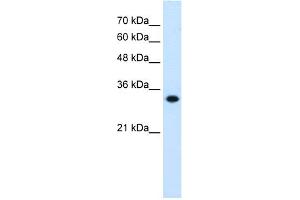 WB Suggested Anti-HMGCL Antibody Titration:  0. (HMGCL anticorps  (C-Term))