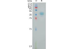 Human PT Protein, hFc Tag on SDS-PAGE under reducing condition.
