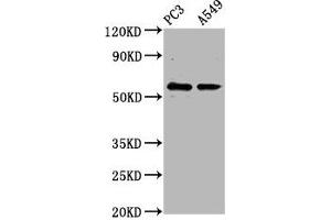 Western Blot Positive WB detected in: PC-3 whole cell lysate, A549 whole cell lysate All lanes: CYP1B1 antibody at 6. (CYP1B1 anticorps  (AA 282-409))