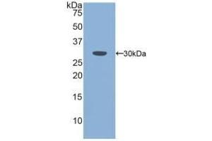 Detection of Recombinant PLS3, Mouse using Polyclonal Antibody to Plastin 3 (PLS3) (Plastin 3 anticorps  (AA 5-251))
