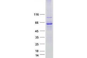 Validation with Western Blot