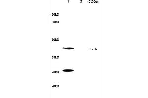 Lane 1: mouse brain lysates Lane 2: mouse kidney lysates probed with Anti HSD17B2 Polyclonal Antibody, Unconjugated (ABIN750193) at 1:200 in 4 °C. (HSD17B2 anticorps  (AA 151-250))