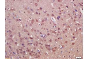 Formalin-fixed and paraffin embedded rat brain labeled with Anti-SUFU/Suppressor of Fused Polyclonal Antibody, Unconjugated  at 1:200 followed by conjugation to the secondary antibody and DAB staining (SUFUH anticorps  (AA 433-484))