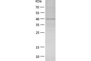 Western Blotting (WB) image for Calcium/calmodulin-Dependent Protein Kinase ID (CAMK1D) (AA 1-385) protein (His tag) (ABIN7122090)
