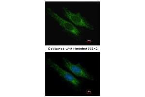 ICC/IF Image Immunofluorescence analysis of methanol-fixed HeLa, using SUCLG2, antibody at 1:200 dilution. (SUCLG2 anticorps)