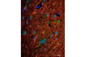 Immunofluorescence analysis of BMPR2 polyclonal antibody  in frozen section of human brain tissue.