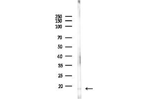 Western blot analysis of lysates from HUVEC cells(UV,30 min treatment), using RPS16 Antibody at 1/1000 dilution.