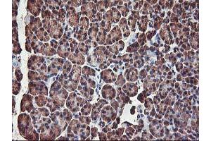 Image no. 6 for anti-V-Akt Murine Thymoma Viral Oncogene Homolog 1 (AKT1) antibody (ABIN1496558) (AKT1 anticorps)