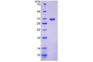 SDS-PAGE analysis of Mouse CAR Protein.
