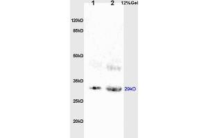 L1 rat brain lysates L2 rat kidney lysates probed with Anti BAMBI Polyclonal Antibody, Unconjugated (ABIN1714490) at 1:200 overnight at 4 °C. (BAMBI anticorps  (AA 101-200))