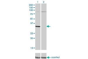 Western blot analysis of PRPS2 over-expressed 293 cell line, cotransfected with PRPS2 Validated Chimera RNAi (Lane 2) or non-transfected control (Lane 1). (PRPS2 anticorps  (AA 160-269))