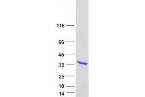 Validation with Western Blot