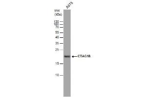WB Image CTAG1B antibody detects CTAG1B protein by western blot analysis. (CTAG1B anticorps)