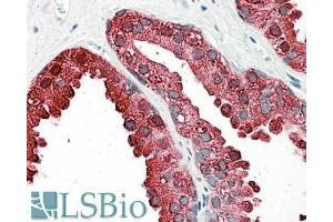 anti-Acid Phosphatase, Prostate (ACPP) (AA 269-282) antibody