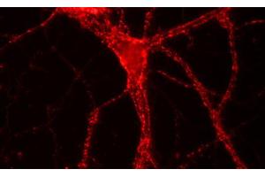 Immunofluorescence labeling of hippocampus neurons, (dilution 1 : 500). (VAMP1, 2, 3 (AA 1-81) anticorps)