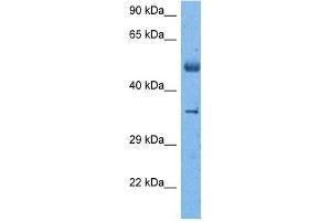 Host:  Rabbit  Target Name:  SUV39H2  Sample Tissue:  Lung Tumor lysates  Antibody Dilution:  1ug/ml (SUV39H2 anticorps  (C-Term))