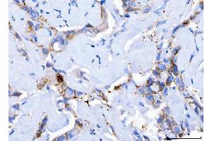 IHC analysis of Desmoglein 2/DSG2 using anti-Desmoglein 2/DSG2 antibody (ABIN7600804). (Desmoglein 2 anticorps  (AA 24-1020))