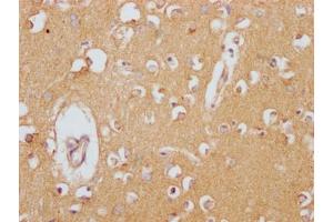 IHC image of ABIN7127430 diluted at 1:100 and staining in paraffin-embedded human brain tissue performed on a Leica BondTM system. (Recombinant Clusterin anticorps)
