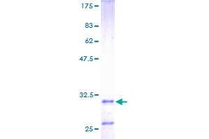 Image no. 1 for Histatin 3 (HTN3) (AA 1-51) protein (GST tag) (ABIN1307254) (HTN3 Protein (AA 1-51) (GST tag))
