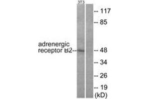 Western blot analysis of extracts from NIH-3T3 cells, using Adrenergic Receptor beta2 (Ab-346) Antibody. (beta 2 Adrenergic Receptor anticorps  (AA 321-370))