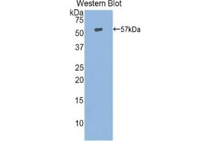 Detection of Recombinant HSPA14, Human using Polyclonal Antibody to Heat Shock 70 kDa Protein 14 (HSPA14) (HSPA14 anticorps  (AA 1-509))
