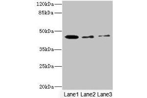 Western blot All lanes: SIGIRR antibody at 1.