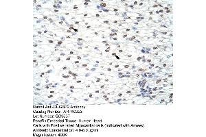 Rabbit Anti-CUGBP2 Antibody  Paraffin Embedded Tissue: Human Heart Cellular Data: Myocardial cells Antibody Concentration: 4. (CELF2 anticorps  (N-Term))