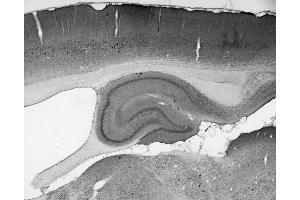 Adult rat hippocampus immunohistochemistry. (SNAPIN anticorps  (AA 115-136))