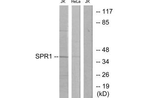Western blot analysis of extracts from Jurkat cells and HeLa cells, using SPR1 antibody. (SPR1 anticorps  (C-Term))